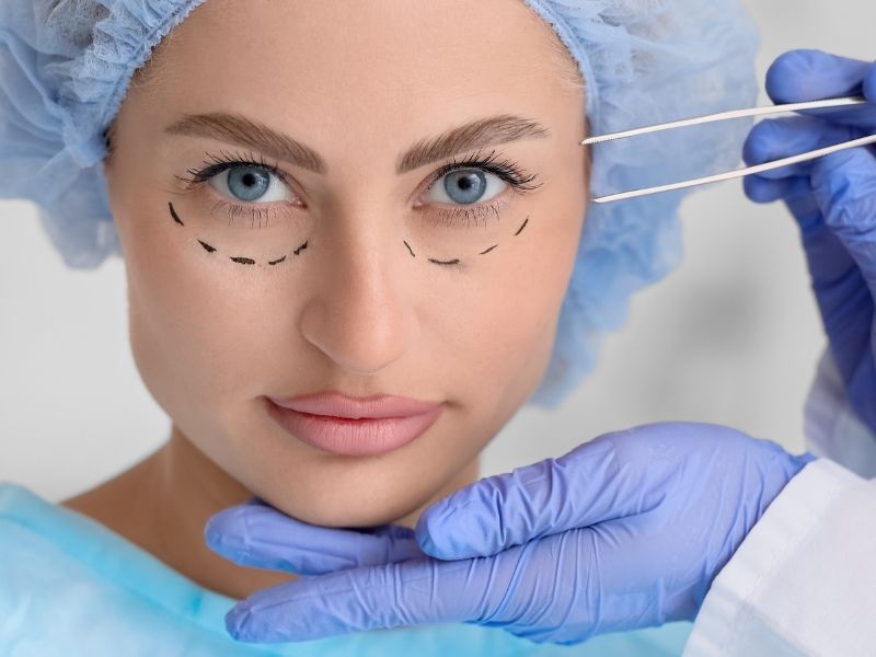 alt-goz-kapagi-estetigi-nasil-yapilir