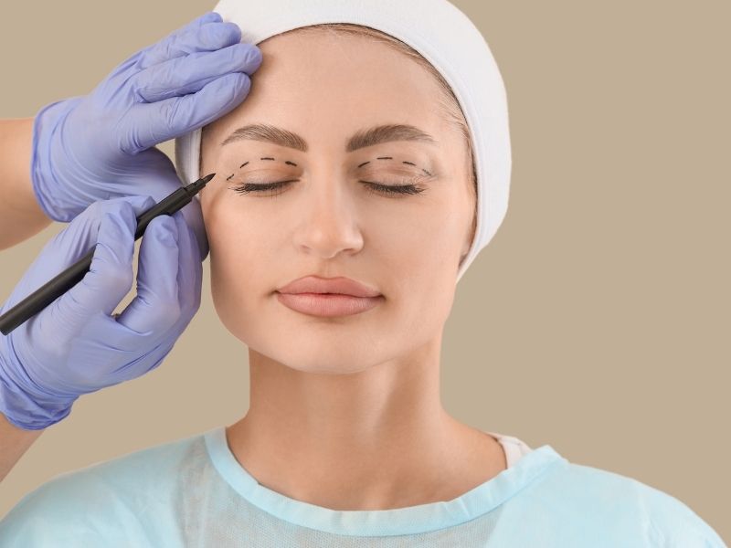 goz-kapagi-estetigi-blefaroplast