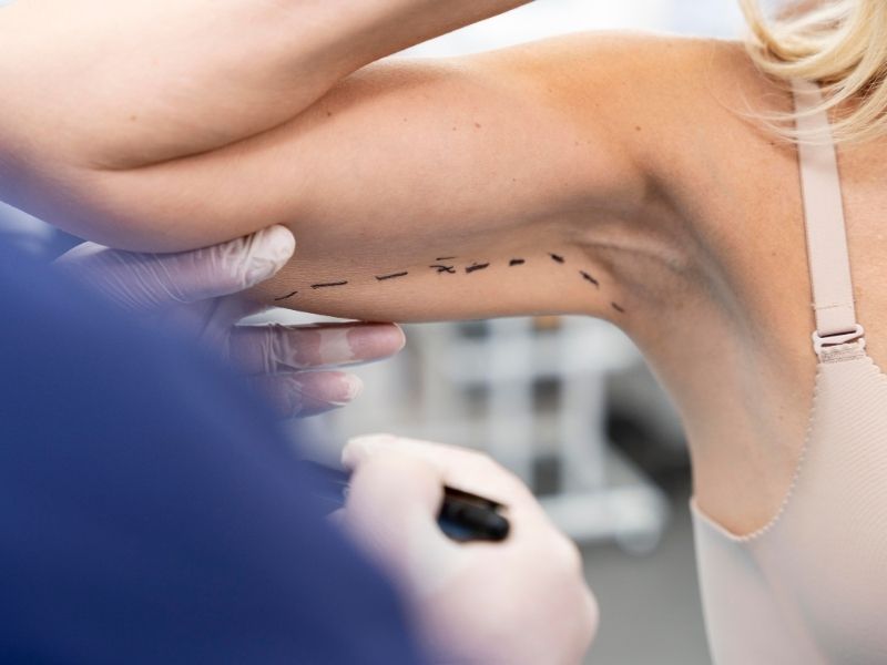 kol-germe-ameliyati-teknikleri