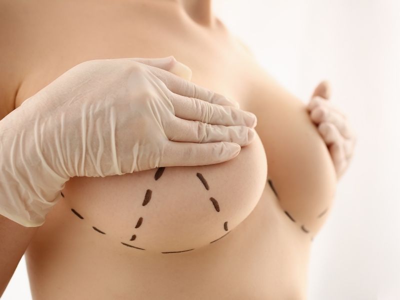 meme-gogus-ameliyati-riskleri-nelerdir