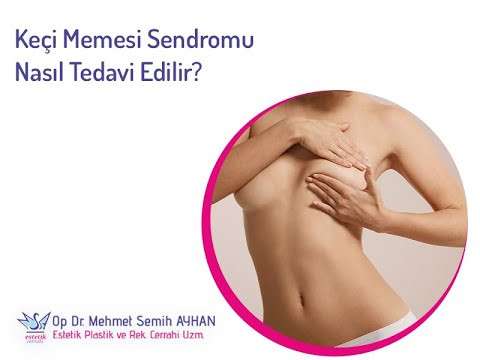 video,paylaşım,kameralı telefon,videofon,ücretsiz,yükleme