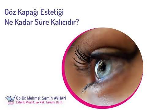 video,paylaşım,kameralı telefon,videofon,ücretsiz,yükleme