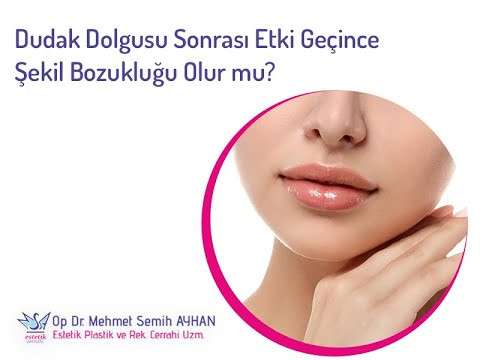 video,paylaşım,kameralı telefon,videofon,ücretsiz,yükleme