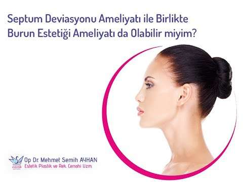 video,paylaşım,kameralı telefon,videofon,ücretsiz,yükleme